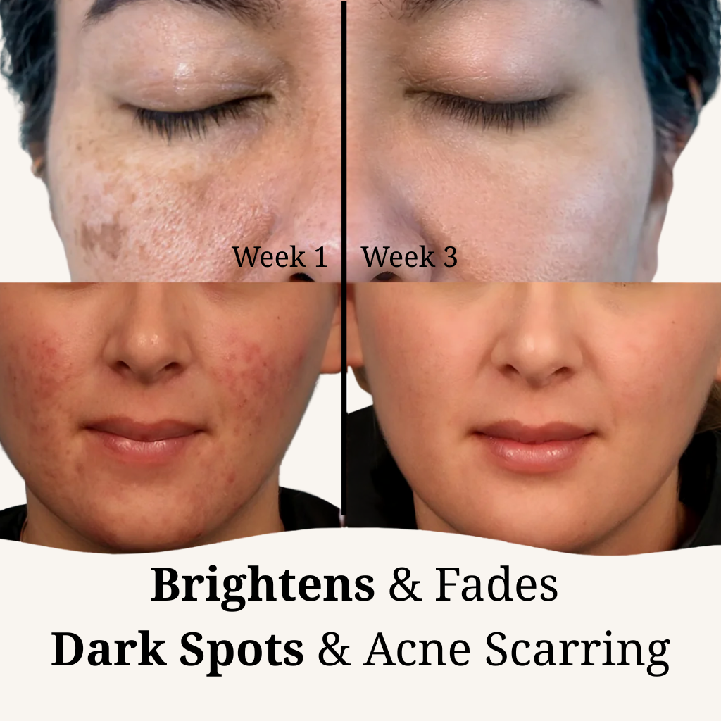 Brightening Turmeric Pads