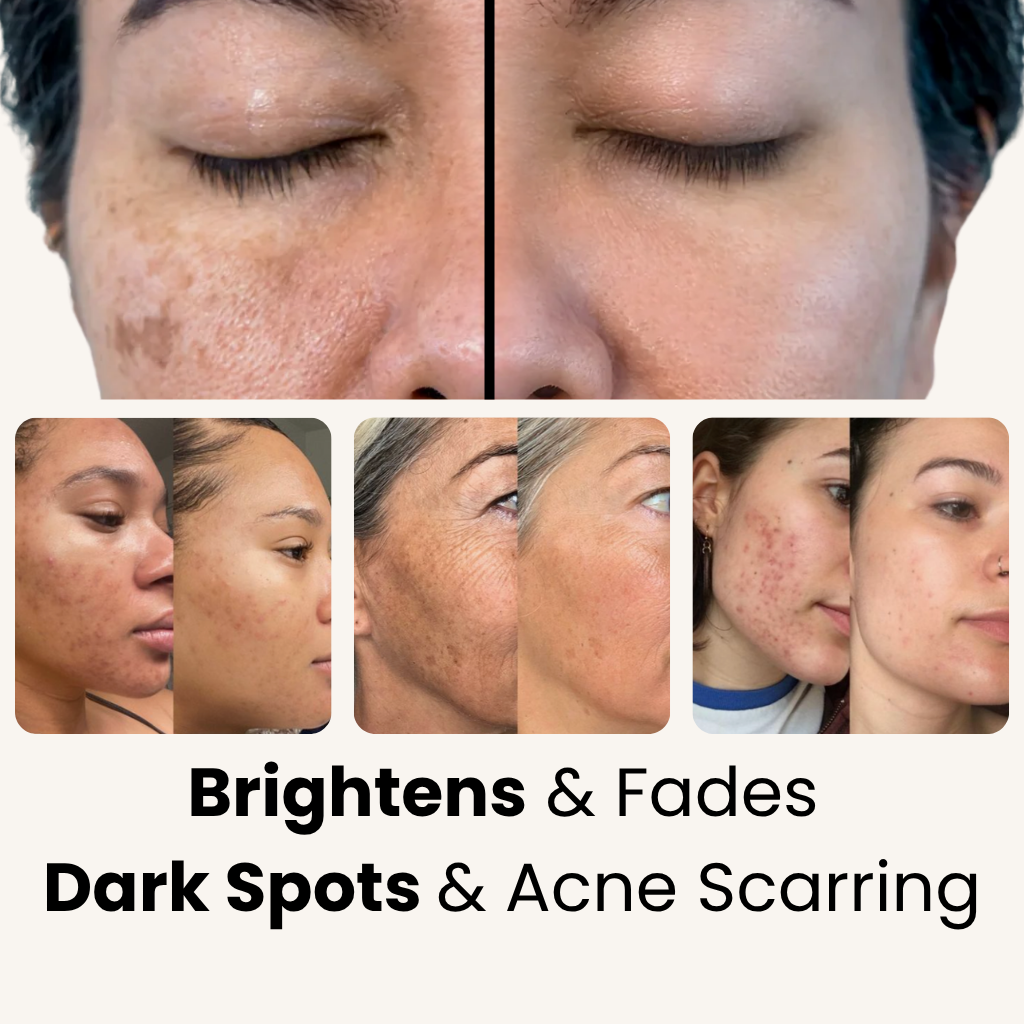 Brightening Turmeric Pads