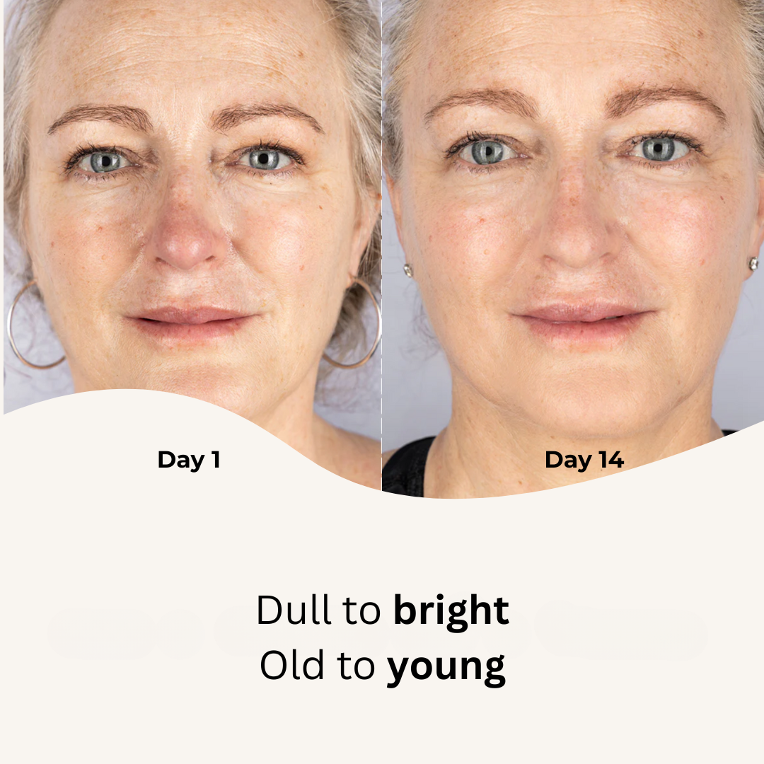 Red Light Therapy Mask
