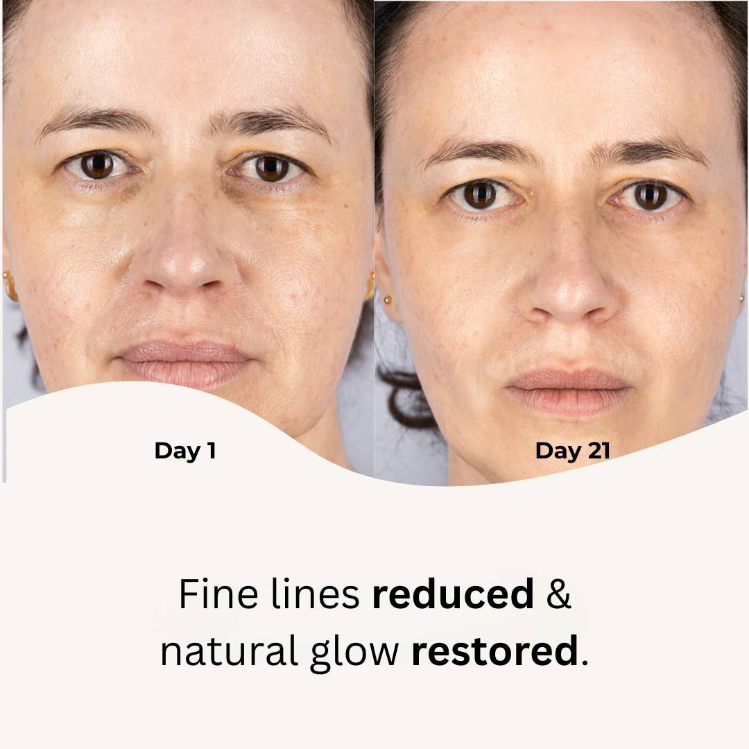 Red Light Therapy Mask