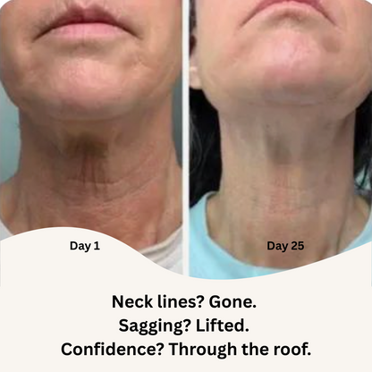 Tightening And Lifting Roller Neck Cream