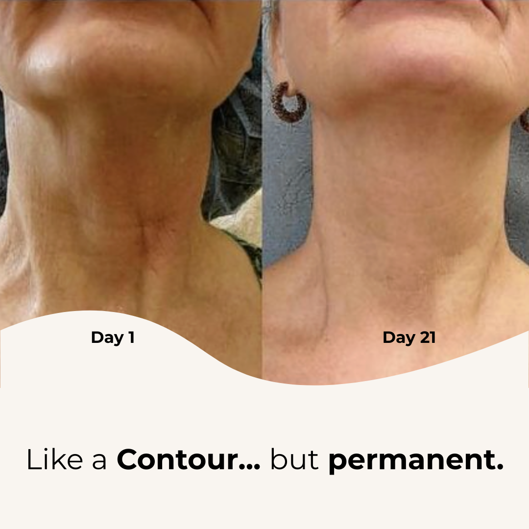 Tightening And Lifting Roller Neck Cream
