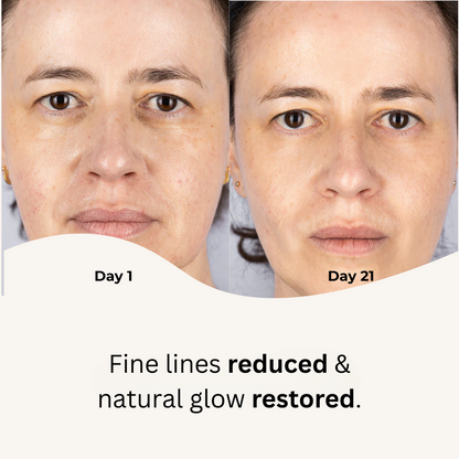 Red Light Therapy Mask