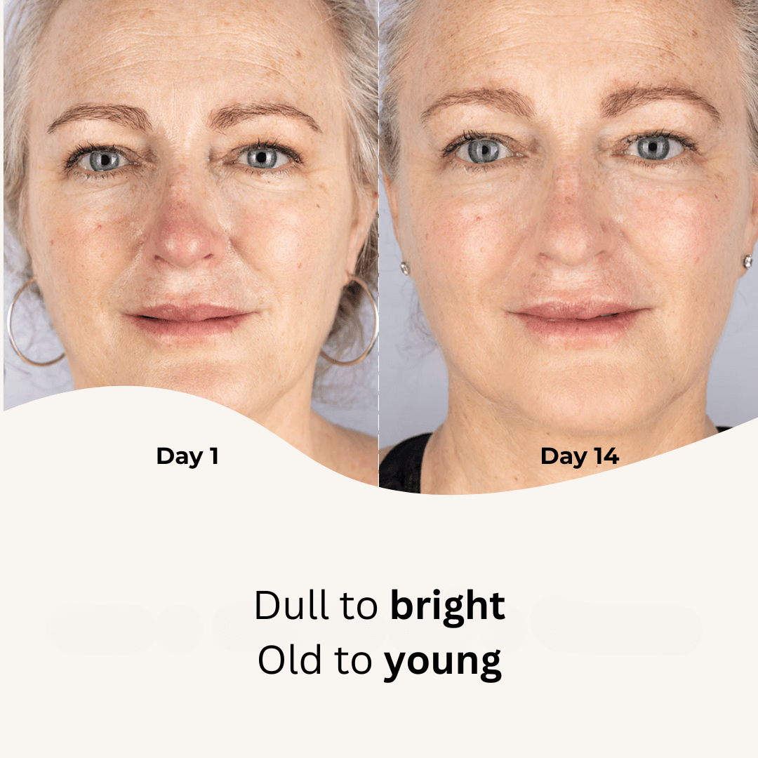 Red Light Therapy Mask - Stella Beauty