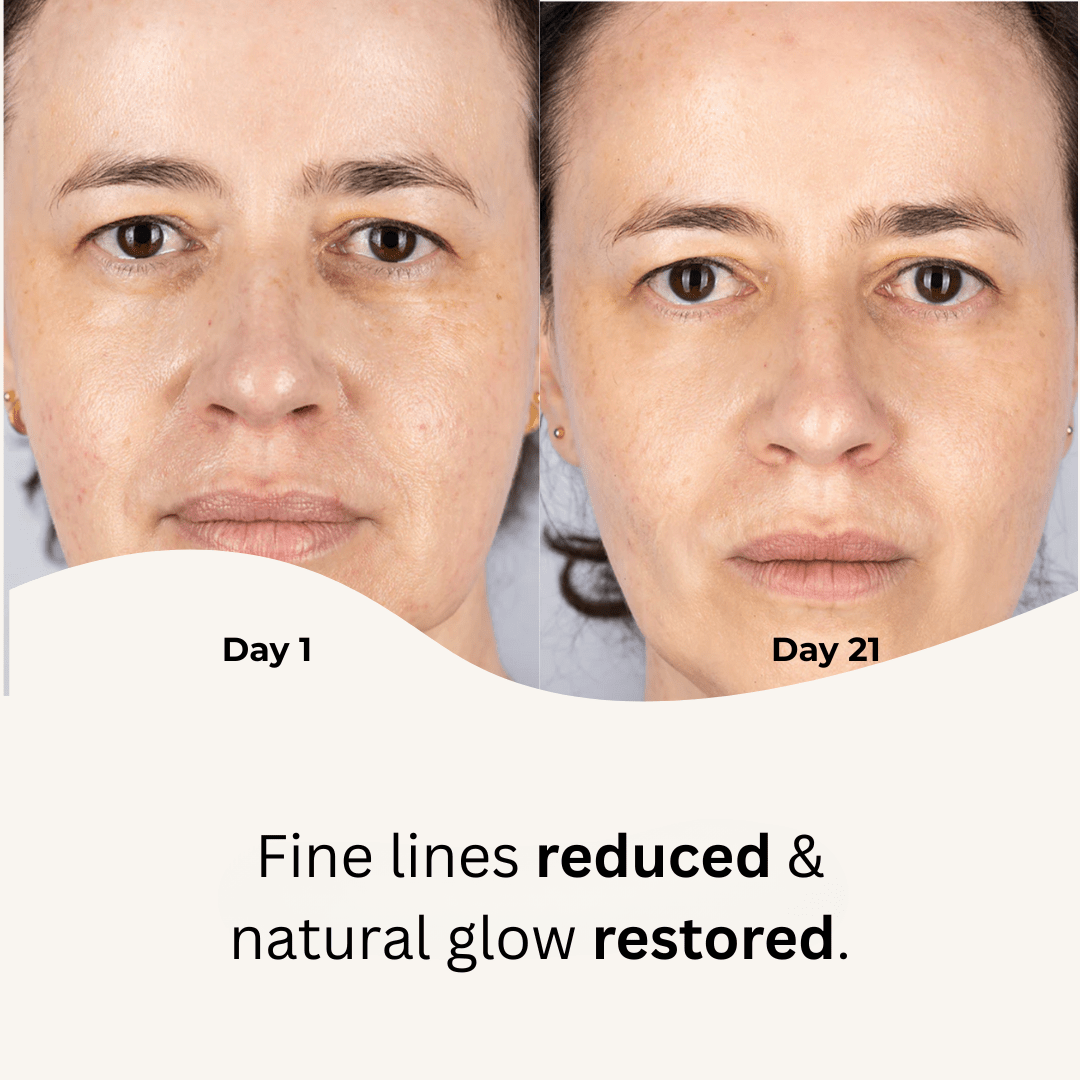 Red Light Therapy Mask - Stella Beauty