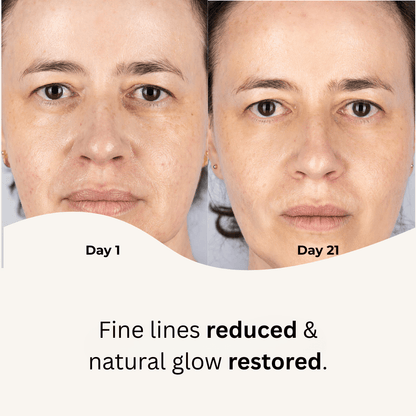Red Light Therapy Mask - Stella Beauty