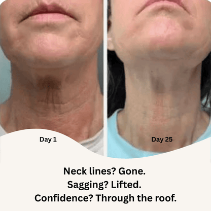 Tightening And Lifting Roller Neck Cream - Stella Beauty